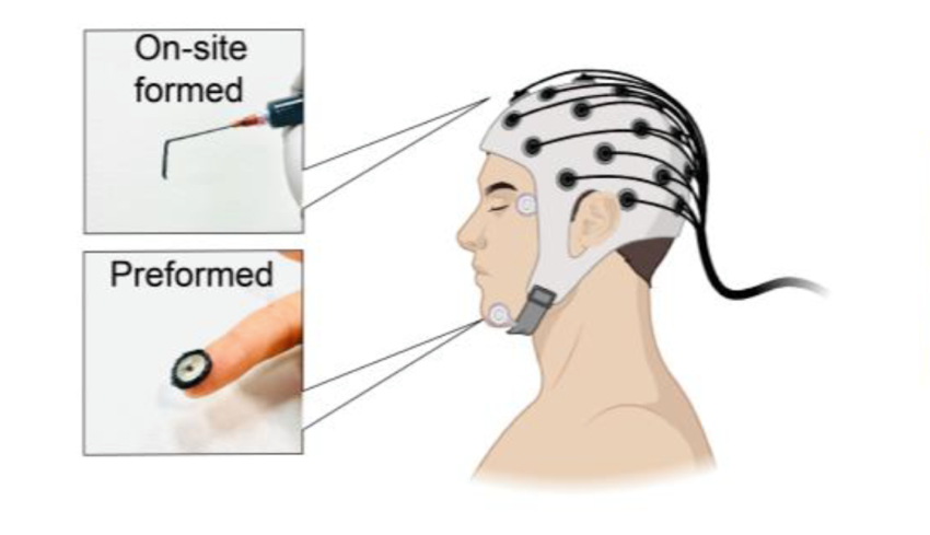A diagram of hydrogel EEG monitoring