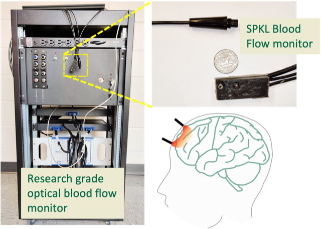 SPKL