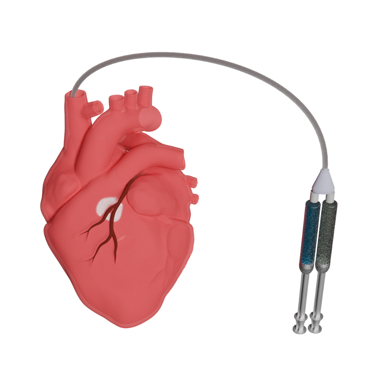 Graphic of catheter connecting to human heart
