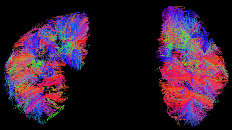 A colorful rendering of an MRI kidney scan by UT Austin engineers.