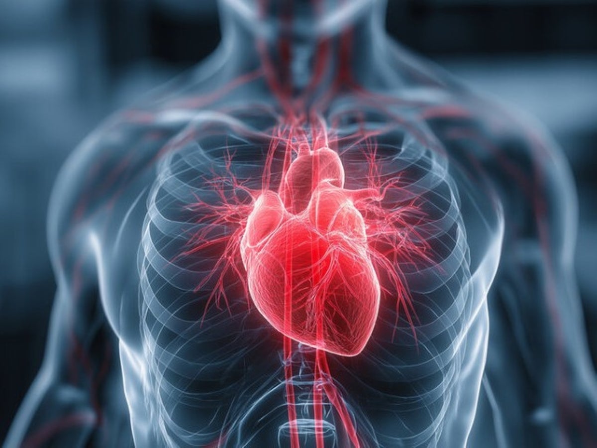 Digital illustration of a heart xray