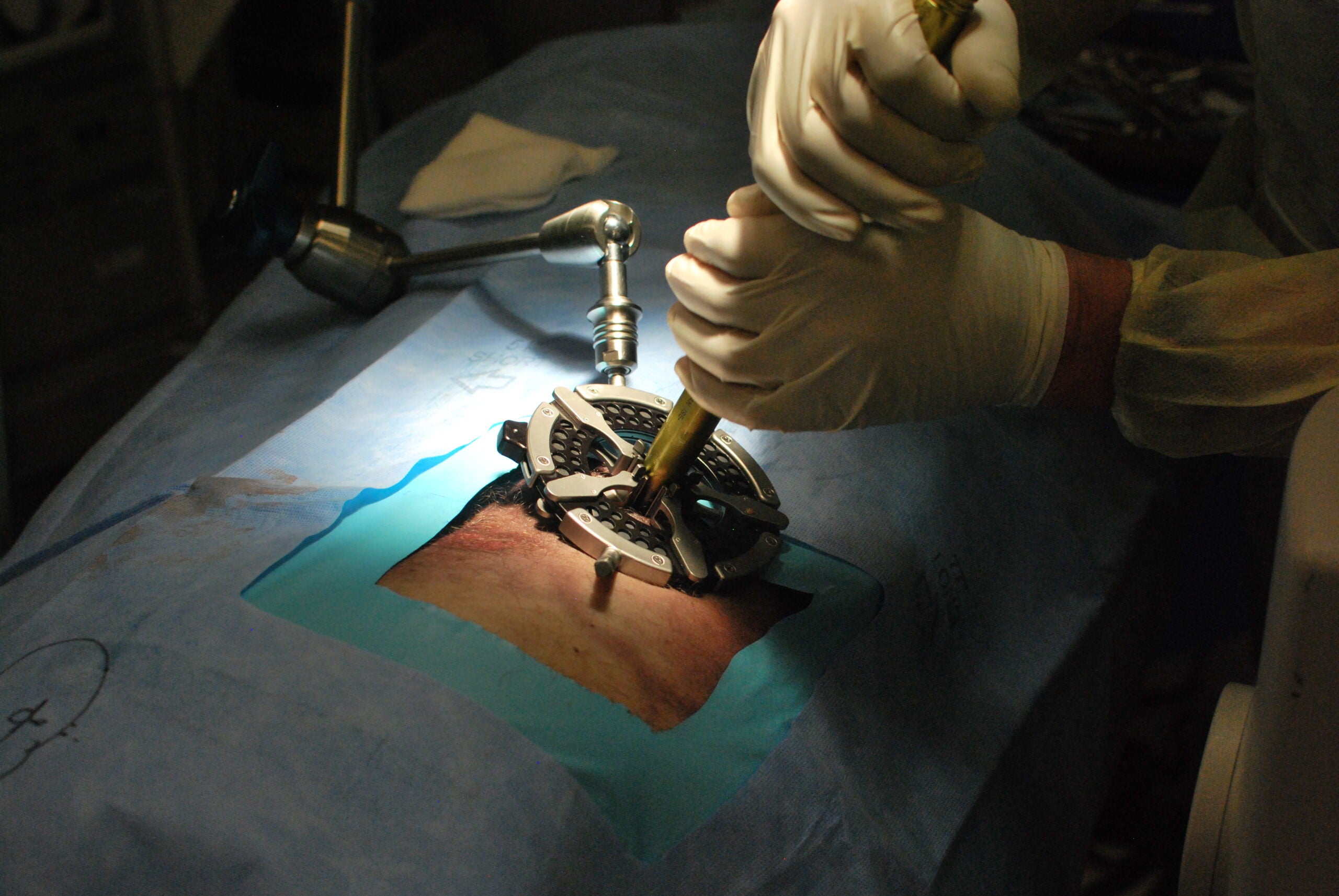 Surgeon performs heart surgery